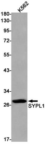 SYPL1 Antibody in Western Blot (WB)