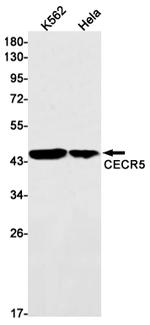 CECR5 Recombinant Rabbit Monoclonal Antibody (K01_1P45)