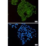 MTH1 Antibody in Immunocytochemistry (ICC/IF)