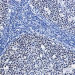 MCM7 Recombinant Rabbit Monoclonal Antibody (K01_1T69)