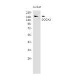 DOCK2 Recombinant Rabbit Monoclonal Antibody (K01_1Q51)