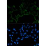 SRSF1 Antibody in Immunocytochemistry (ICC/IF)