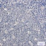 SRSF1 Antibody in Immunohistochemistry (Paraffin) (IHC (P))