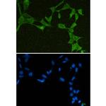 DDX21 Recombinant Rabbit Monoclonal Antibody (K01_1Q31)
