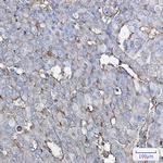 GNAQ Recombinant Rabbit Monoclonal Antibody (K01_1R84)