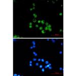 MEF2A Recombinant Rabbit Monoclonal Antibody (K01_1T75)