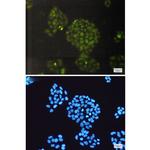 ERCC1 Recombinant Rabbit Monoclonal Antibody (K01_1Q88)