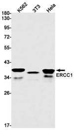 ERCC1 Antibody in Western Blot (WB)