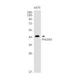 PHLDA1 Recombinant Rabbit Monoclonal Antibody (K01_1W71)