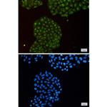 PSMB8 Antibody in Immunocytochemistry (ICC/IF)