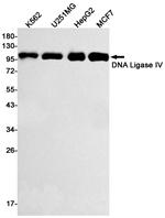 DNA ligase IV Recombinant Rabbit Monoclonal Antibody (K01_1Q47)