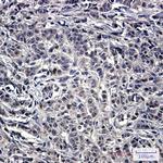 NOLC1 Antibody in Immunohistochemistry (Paraffin) (IHC (P))