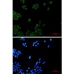 NDUFB4 Recombinant Rabbit Monoclonal Antibody (K01_1U54)