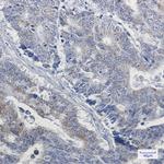 NDUFB4 Antibody in Immunohistochemistry (Paraffin) (IHC (P))