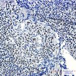 RPA2 Antibody in Immunohistochemistry (Paraffin) (IHC (P))