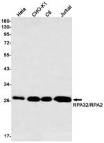 RPA2 Antibody in Western Blot (WB)