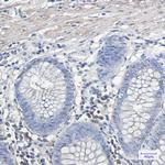 IL11RA Recombinant Rabbit Monoclonal Antibody (K01_1S83)