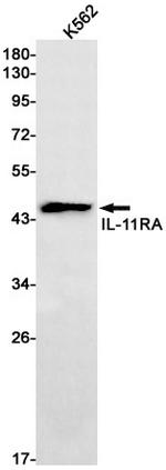 IL11RA Antibody in Western Blot (WB)