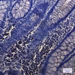 NUDT19 Antibody in Immunohistochemistry (Paraffin) (IHC (P))