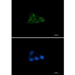 NDUFAF4 Recombinant Rabbit Monoclonal Antibody (K01_1U49)