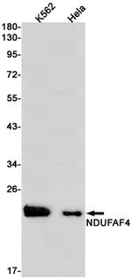 NDUFAF4 Antibody in Western Blot (WB)
