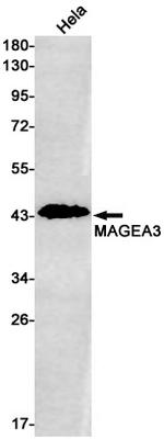 MAGEA3 Recombinant Rabbit Monoclonal Antibody (K01_1T60)
