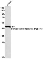 SSTR3 Recombinant Rabbit Monoclonal Antibody (K01_1Y64)