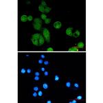 NBS1 Antibody in Immunocytochemistry (ICC/IF)