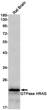 N-Ras Antibody in Western Blot (WB)