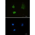 PSMA2 Recombinant Rabbit Monoclonal Antibody (K01_1X16)