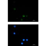 SSX2IP Recombinant Rabbit Monoclonal Antibody (K01_1Y74)