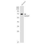 SSX2IP Antibody in Western Blot (WB)