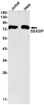 SSX2IP Antibody in Western Blot (WB)