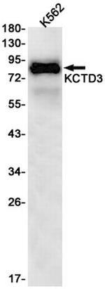 KCTD3 Recombinant Rabbit Monoclonal Antibody (K01_1T22)