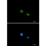 FUBP1 Recombinant Rabbit Monoclonal Antibody (K01_1R41)