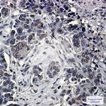 FUBP1 Antibody in Immunohistochemistry (Paraffin) (IHC (P))