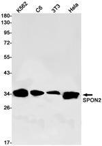 SPON2 Recombinant Rabbit Monoclonal Antibody (K01_1Y70)