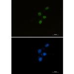CHK2 Recombinant Rabbit Monoclonal Antibody (K01_1P52)