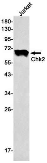 CHK2 Antibody in Western Blot (WB)
