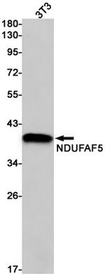 NDUFAF5 Antibody in Western Blot (WB)
