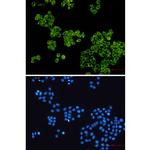 GYS1 Recombinant Rabbit Monoclonal Antibody (K01_1R80)