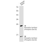 Phospho-Phospholamban (Ser16) Antibody in Western Blot (WB)