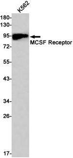 CSF1R Recombinant Rabbit Monoclonal Antibody (K01_1T71)