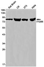 ITGB6 Recombinant Rabbit Monoclonal Antibody (K01_1T09)