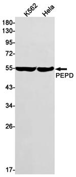 PEPD Recombinant Rabbit Monoclonal Antibody (K01_1W57)
