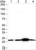 UQCRFS1 Antibody in Western Blot (WB)