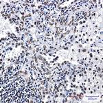 ILF3 Antibody in Immunohistochemistry (Paraffin) (IHC (P))