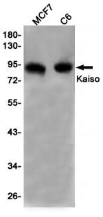 Kaiso Recombinant Rabbit Monoclonal Antibody (K01_1T17)