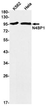 N4BP1 Recombinant Rabbit Monoclonal Antibody (K01_1U39)