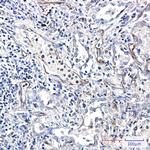 Moesin Recombinant Rabbit Monoclonal Antibody (K01_1U03)